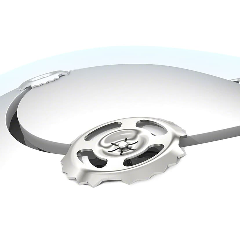 Scull fracture repair with CranioFix® 2-Product Picture Enlargement CW