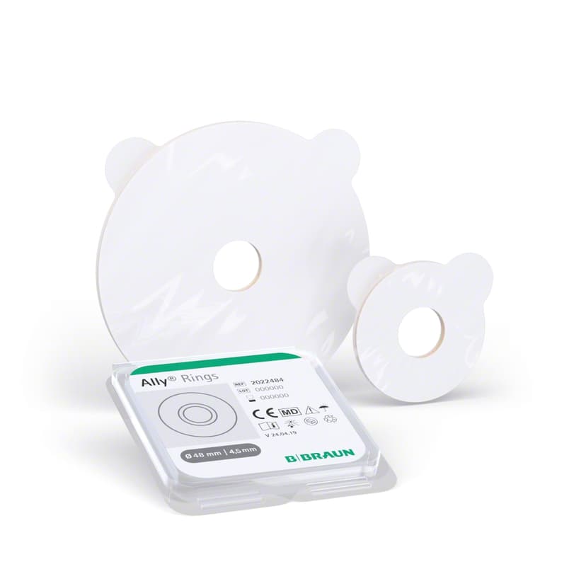 Ally Rings in three sizes-Product picture