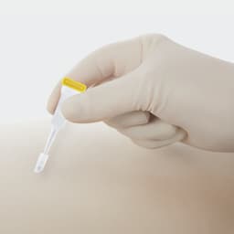 Histoacryl® Flexible clear handling-Tissue Adhesive